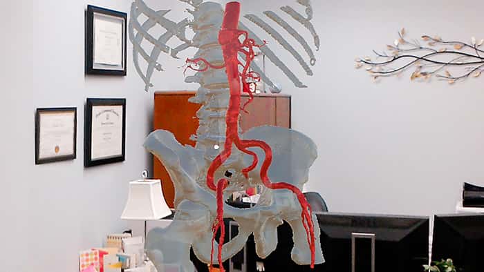 3D detail of skeletal model and artery