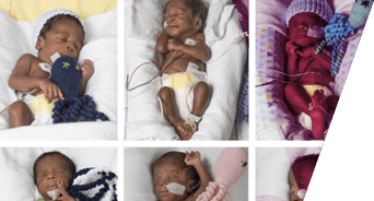 The Taiwo sextuplets in beds at the neonatal intensive care unit